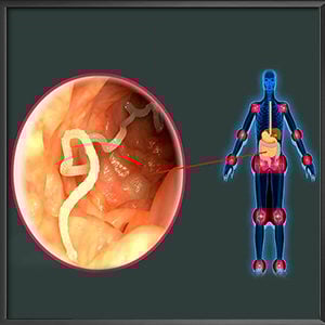 Intestinal worm infections